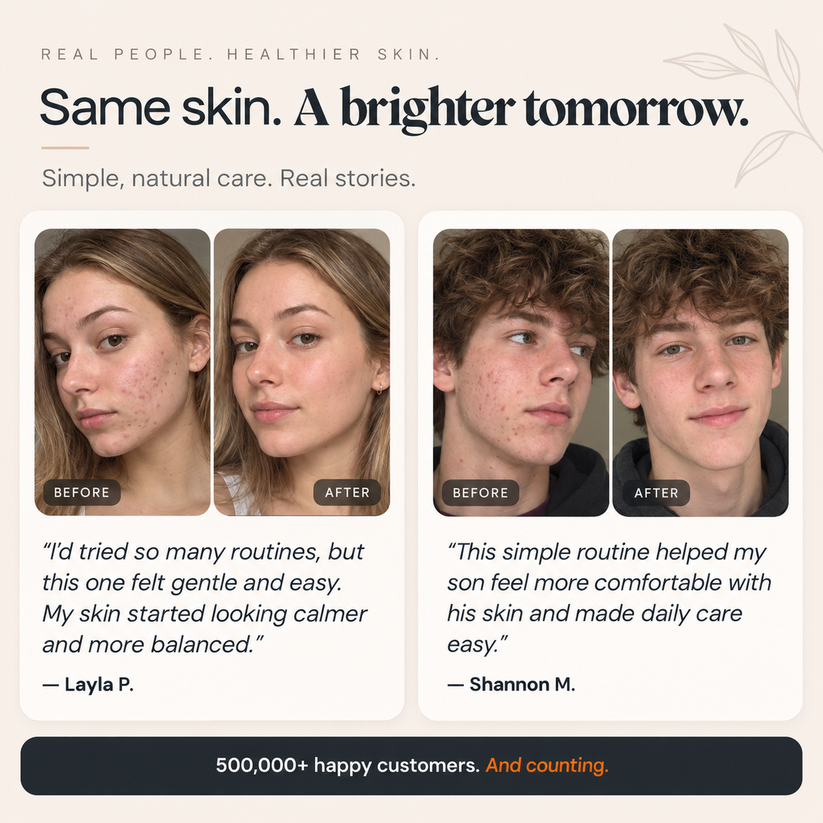 The Complete System for Acne-Prone Skin